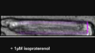 cardiac myocyte contractility [upl. by Mahala345]