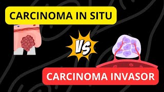 Carcinoma in situ versus Carcinoma invasor [upl. by Kentigerma]