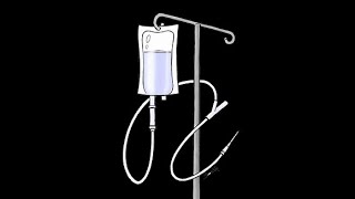 Hyperglycemic Hyperosmolar State  HHS [upl. by Rolan]