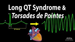 Long QT Syndrome and Torsades de Pointes Animation [upl. by Henig]