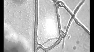 Anastomosis in mycorrhizal fungi [upl. by Mateo687]