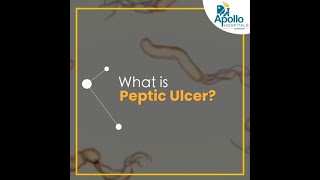 Peptic Ulcer Disease Signs amp Symptoms  Apollo Hospitals Guwahati [upl. by Godart]