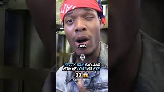 Fetty Wap EXPLAINS how he LOST His EYE 👀 [upl. by Ylicec]