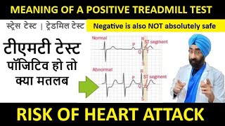 Understand Positive Exercise Stress Test  TMT  High Risk of Heart Attack  DrEducation Hindi Eng [upl. by Chapel]