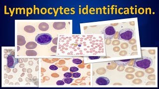 Lymphocytes identificationLymphocytesWBCWhitebloodcellsHematologyMLS [upl. by Eerrahs]