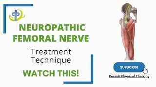 Neuropathic Femoral Nerve Treatment Technique [upl. by Childers]