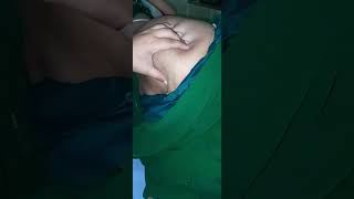 mahila ke Buttock me Injection Kaise lagaye  injection video Indian hospital Injection vlog video [upl. by Enirolf813]