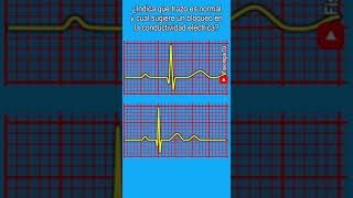 Electrocardiograma interpretación  ¿Indica que trazo es normal y cual sugiere un bloqueo [upl. by Yromem578]