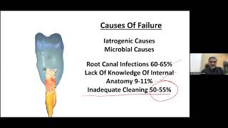 IRRIGANTS IN ENDODONTICS ACTIVATION STRATAGIES  DR MANDAR PIMPRIKAR  SAFE DENTAL UPDATES [upl. by Eceela]