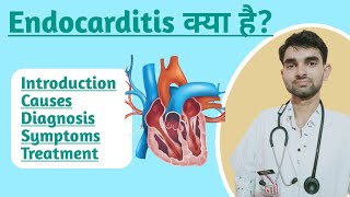 Endocarditis in Hindi  Causes Symptoms  Diagnosis and Treatment of Endocarditis [upl. by Amairam416]