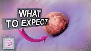 Embryo Transfer Day Behind the Scenes What to Expect [upl. by Bryana]