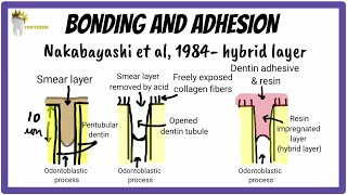 Enamel and Dentin Bonding Made SUPER EASY  Dental Materials [upl. by Narruc965]