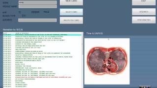 video for LRIS software operation [upl. by Bunnie653]