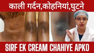 1 क्रीम सारी प्रोब्लम के लिए  OJAS by Dr Shaista Khan trending skin body [upl. by Daria]