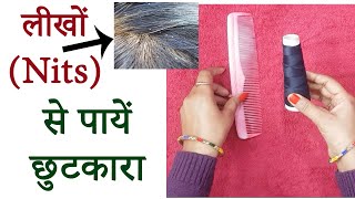 Nits How to Remove Lice from Hair Permanently Homeremedies at Home in Hindi लीखो से पाएं छुटकारा [upl. by Aniala667]