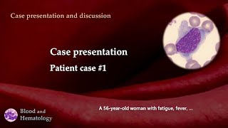 Patient case presentation case 1 [upl. by Auj]