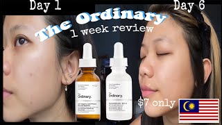 I tried The Ordinary Niacinamide amp Rosehip oil for 7 days  Honest Review Malaysia [upl. by Shirlee]