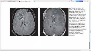 BRAIN DIAGNOSTIC IMAGING SERIES [upl. by Scotti]