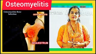 Osteomyelitis  Causes Symptom Treatment Diagnosis Medical Surgical amp Nursing Management [upl. by Ahsenrac]