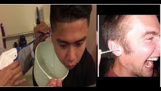 EPIC EAR WAX REMOVAL  Elephant Ear Washer Bottle System by Doctor Easy [upl. by Notfol]