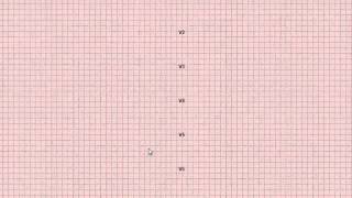 User Guide  Welch Allyn CardioPerfect ProResting ECG amp Software [upl. by Nedi13]