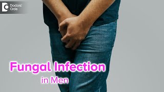 Fungal infection in Men Causes amp Treatment  Yeast Infection in Men Dr Nischal KDoctors Circle [upl. by Earle]