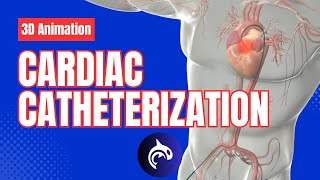 Cardiac Catheterization  3D Animation [upl. by Eisset]