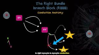 Understanding Right Bundle Branch Blocks  Good Reads 92024 [upl. by Bret]