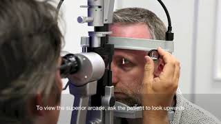 Slit Lamp setup and fundal assessment with a 90d lens [upl. by Eenehs867]