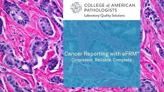 Cancer Reporting with eFRM [upl. by Tamis]