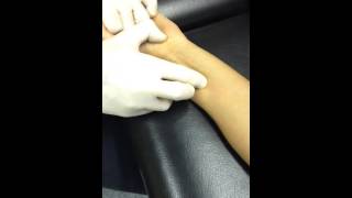 Flexor Pollicis Longus Dry Needling [upl. by Gates]