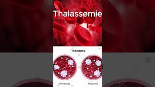 THALASSEMIE [upl. by Ayouqes]