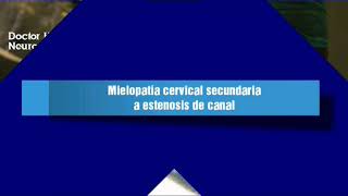 Mielopatía cervical secundaria a estenosis de canal [upl. by Nosreffej]