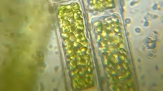 Rhizoclonium pond algae under microscope100x450x1000x1500 [upl. by Monahon]