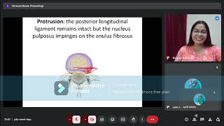 Prolapsed Intervertebral Disc Anatomy of IV Disc Part4 [upl. by Egres]