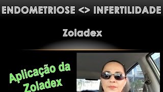 Endometriose  Aplicação Zoladex  Roberta Duarte [upl. by Sama834]