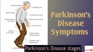 Clinical Presentation Of Parkinson DiseaseStages Of Parkinson DiseaseParkinsons Disease Symptoms [upl. by Ilke]