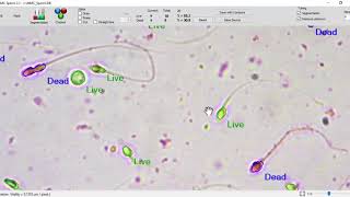 MMC Sperm sperm vitality analysis [upl. by Ahsie]