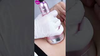 How to use cavitation radio frequency machine for weight loss treatment [upl. by Ohcirej349]