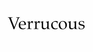 How to Pronounce Verrucous [upl. by Ennayehc548]