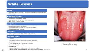 Chapter 15 ORAL PATHOLOGY AND ORAL SURGERY [upl. by Cirdes]