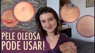 Como usar o ÓLEO DE ROSA MOSQUETA no rosto e no corpo  oleoderosamosqueta oleosvegetais skincare [upl. by Isahella]