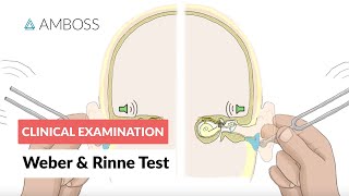 Weber and Rinne Test  Clinical Examination [upl. by Cia428]