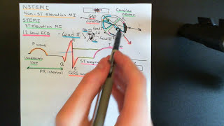 Coronary Artery Disease Part 8 [upl. by Warenne690]