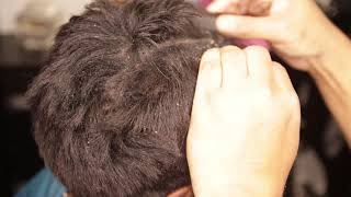 Scalp Scratching  Dandruff Removal Close Up [upl. by Weinrich351]