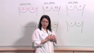 Types of Mastectomies What is nipplesparing reconstruction  Sonia Sugg MD [upl. by Loredo]