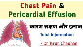 Pericardial Effusion in hindi  chest pain and pericardial effusion  seene me dard [upl. by Annairdna57]