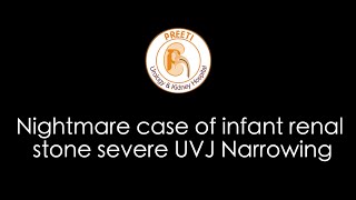 Nightmare case of infant renal stone severe UVJ Narrowing [upl. by Georgeanna]