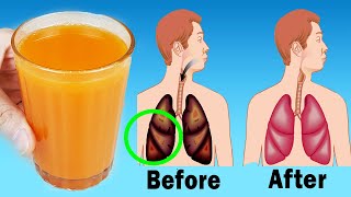 Remedy For Cleaning Lungs  Remove Mucus From Your Lungs And Improve Respiratory [upl. by Resarf]