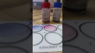 Widal Test 🩸 sorts shorts shortvideo science pathology lab lablife medicallab viralvideo [upl. by Nyvlem]